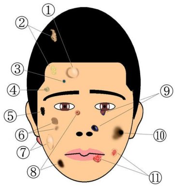 顔のできものについて